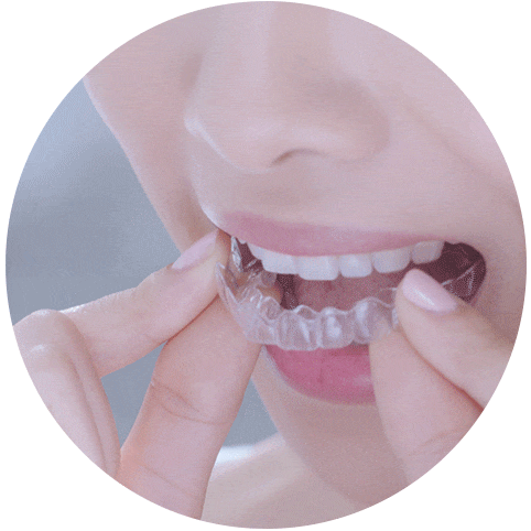 Aligner Process Animation